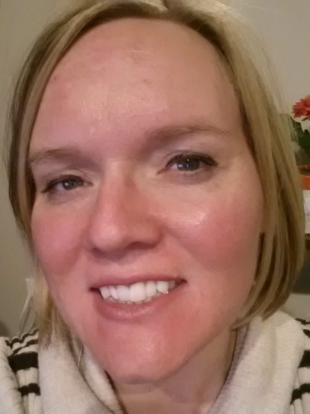 How can I fix scars on my face, utah